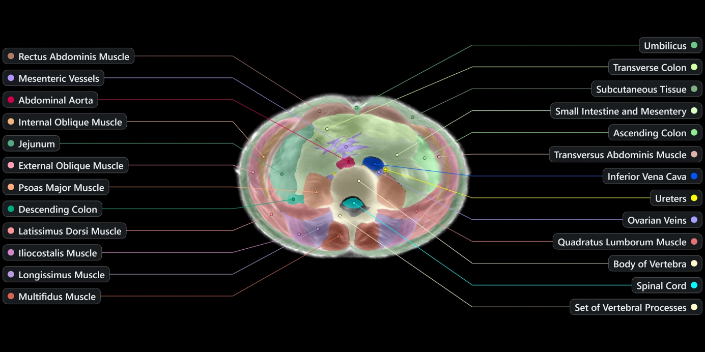 Transformation of raw acoustic data into a 3D spatial model