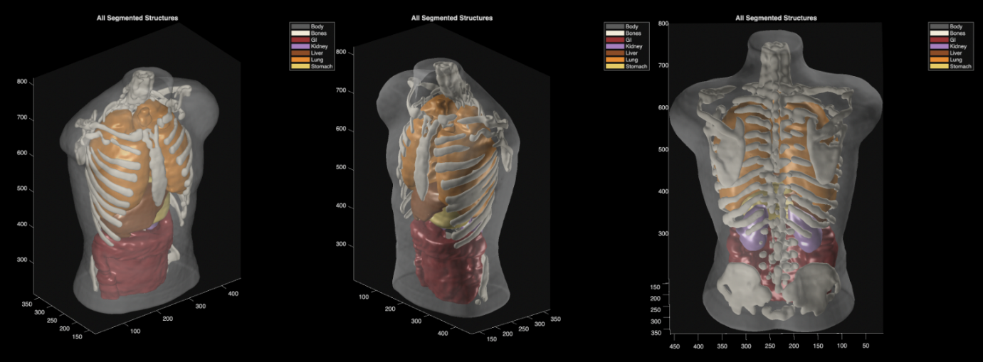 Axial semantic segmentation map of the lower abdominal region